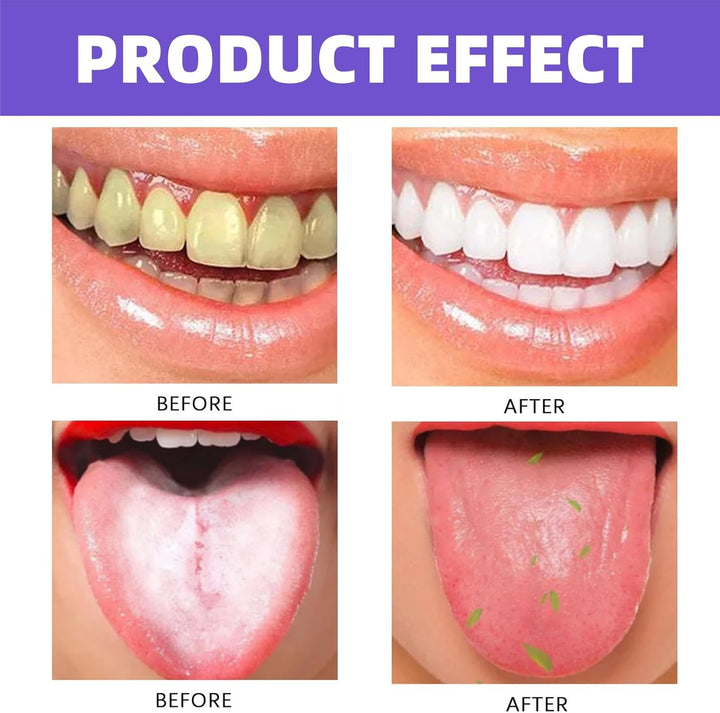 Pro-Biotic Oral Spray,Pro-Biotic Breath Spray,Mouth Spray,Breath Freshener Spray,Bad Breath Treatment for Adults,Fresh Breath Spray for Bad Breath,Long-Lasting Mouth Freshener Spray,Dry Mouth Spray