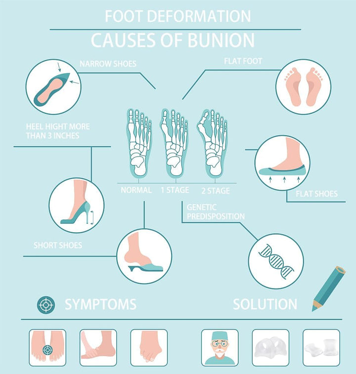 Toe Separators to Correct Your Toes 12 Pcs, Big Toe Spacers for Overlapping Toes Bunions Hammer Toe Relaxation Restore Toes to Their Original Shape, Toe Straighteners Toe Support
