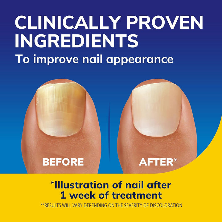 Nail Revitaliser Serum 10Ml - Visible Results in Just 2 Days, Triple Action: Brightens, Smooths and Moisturises, Nails and Toenails Damaged by Fungal Nail