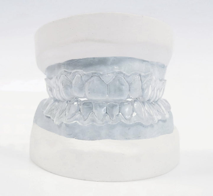 Teeth Whitening Dental Trays - Custom Made by Professionals Using a DIY Home Impression Kit (New Improved Longer Lasting Material)