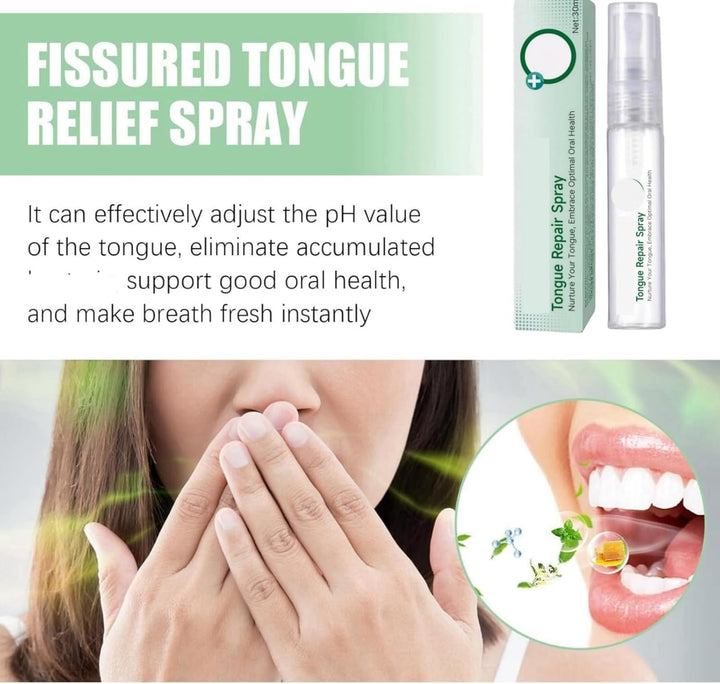Tongue Repair Spray,So/Re Tongue Relief,Breath Freshener Spray,So/Re Mouth and Ton-Gue Treatment,Remove White Dirt,Instant Dry Mouth Relief,Moisturizing,Natural Ingredients,Mild and Non-Irritating