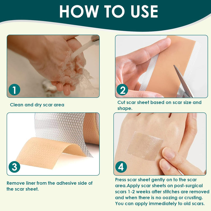 Silicone Scar Sheets, Premium Silicone Gel Scar Tape, Reusable Silicone Patches, Painless Silicone Tape Roll, Silicone Scar Tape for Surgeries Scars, C-Sections, 1.6'' X 120''Roll-3M