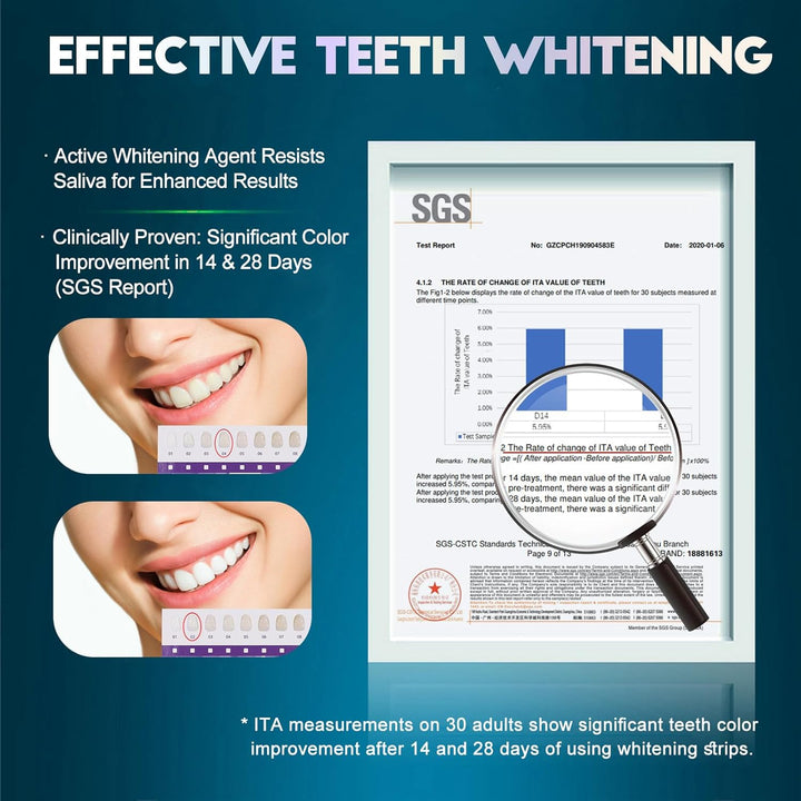 Teeth Whitening Strips for Tooth White: Professional Dentist Formulated Teeth Whitener Enamel 14 Treatments Enamel-Safe – 28 Non-Sensitive Strips (28 Count (Pack of 1), Mild Mint)