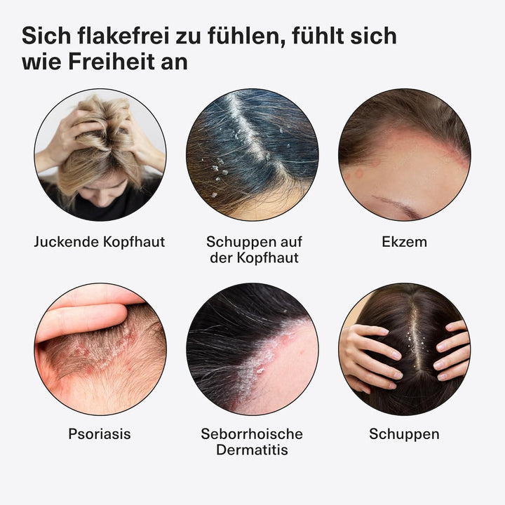 Healpsorin Psoriasis Scalp Treatment Conditioner - Helps Relieve Dandruff, Seborrheic Dermatitis & Psoriasis Symptoms for Shiny, Flake-Free Hair. 500Ml