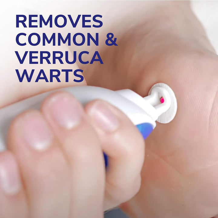 Freeze Away Max Verruca and Wart Remover for Hands and Feet - as Fast as 10 Seconds to Treat Warts and Verrucas, Safe for Children Aged 4 and Above
