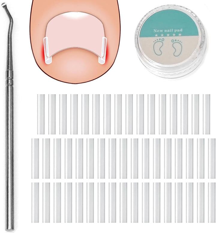 50 PCS Ingrown Toenail Corrector Set - Pain-Free Toenail Straightener Strips with Lifter Tool - Easy Use Foot Care Kit for Men & Women