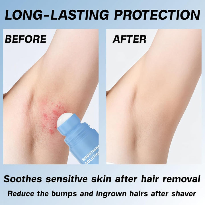 2 Pcs Smoothing Solution Ingrown Hair Treatment,Razor Bumps Treatment for Women Underarm,After Shave Soothing Roll-On Serum,Gently Clean Armpits Moisturizing and Skin Soothing Serum,Shaving Oil Women