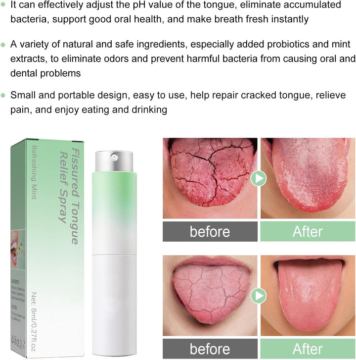 Fissured Tongue Relief Spray,Tongue Repair Spray,Sore Tongue Relief Sore Tongue Relief Mint Breath Spray,Moisturising Dry Mouth Relief Spray,Breath Freshener
