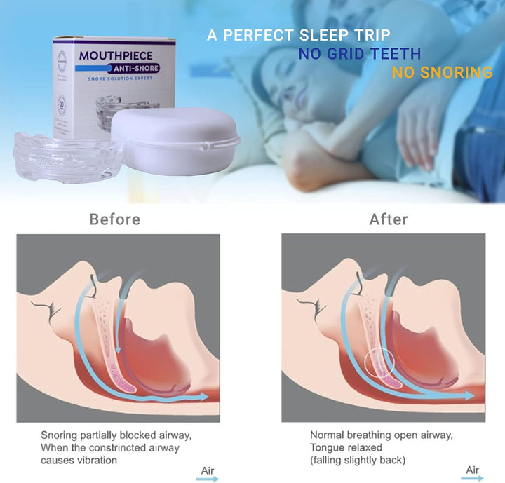 Anti Snoring Mouthpiece anti Snoring Devices for Men Snore Stopper, Sleep Mouthpiece-Ready to Use anti Snore - XL