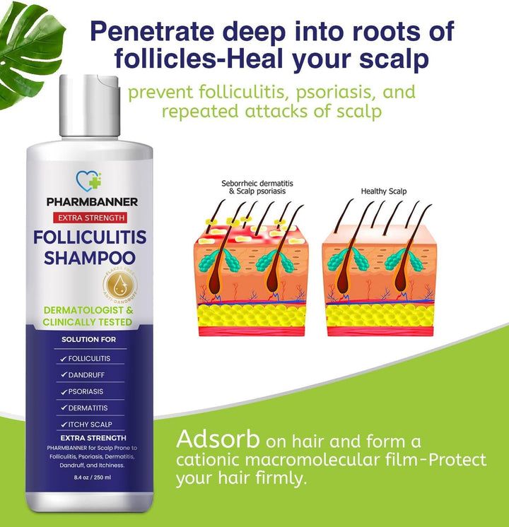 Folliculitis & Seborrheic Dermatitis Shampoo – Anti-Dandruff, Psoriasis & Itchy Scalp Treatment – Soothes Redness, Flaking & Irritation – 250Ml