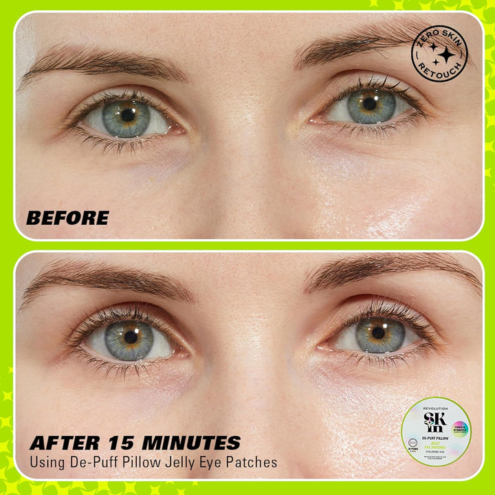 Revolution Skin, De-Puff Pillow Hyaluronic Acid Jelly Eye Patches, Hydrogel Patches, Cools & Hydrates Under-Eyes, Vegan & Cruelty-Free, 30 Pairs