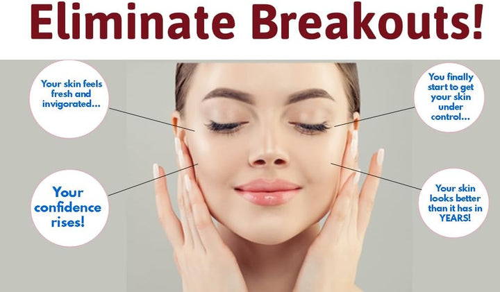 Salicylic Acid, Tea Tree Oil and Sulphur Soap Scrub for Spots Blackheads Milia Blemishes Problem Skin Suitable and Safe for Those Prone to Acne - Paraben and Cruelty FREE - 100 G