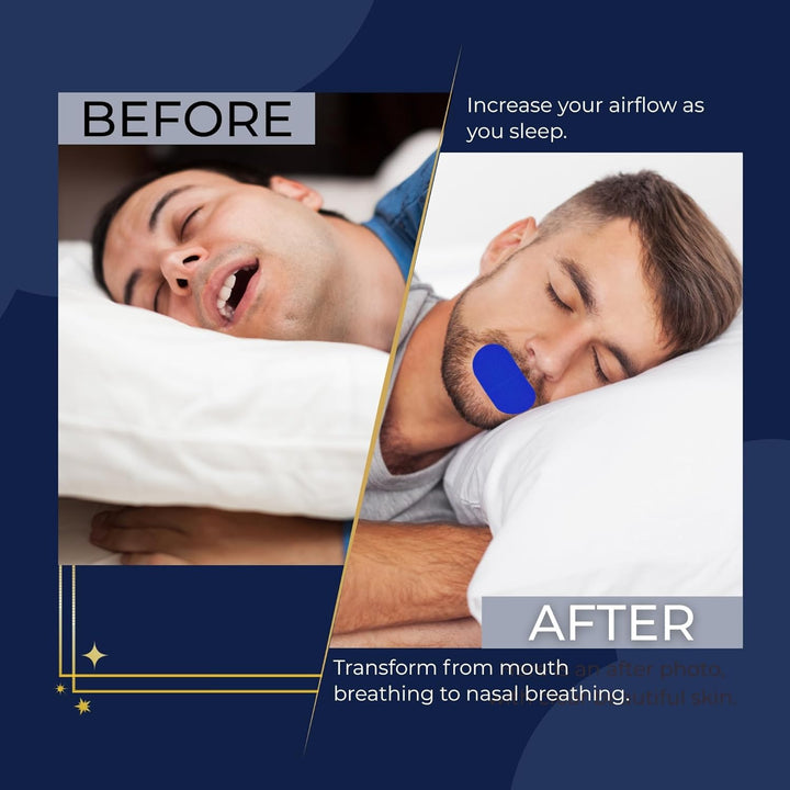 Sleep Tape – anti Snoring Aid & Mouth Tape for Sleeping, Enhanced Nasal Breathing with Gentle Adhesion, 30 Strips to Stop Snoring & Improve Sleep Quality