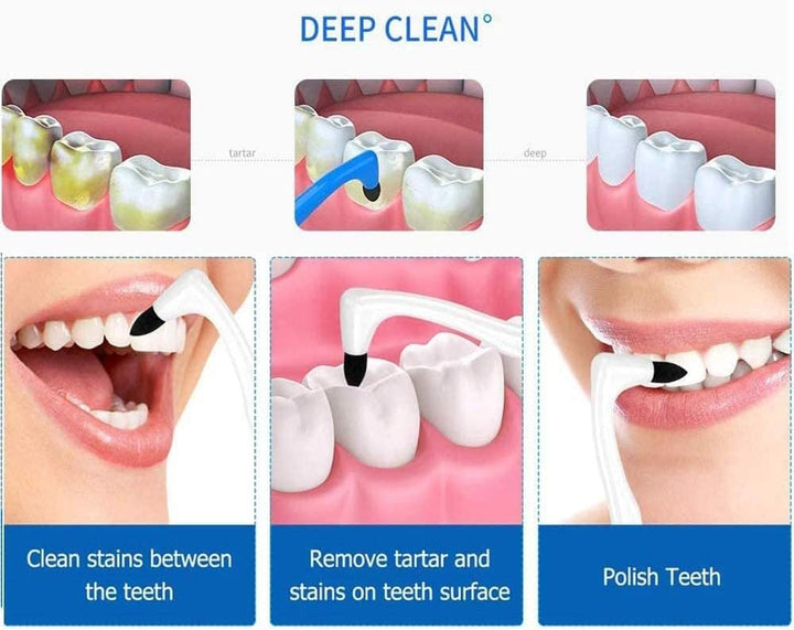 Teeth Tartar Remover, Professional Tooth Stain Eraser, Teeth Polishing Cleaning Kit Removes Plaque & Impurities Whitening Oral Hygiene Care Tool - (2 Pack, White & Blue)