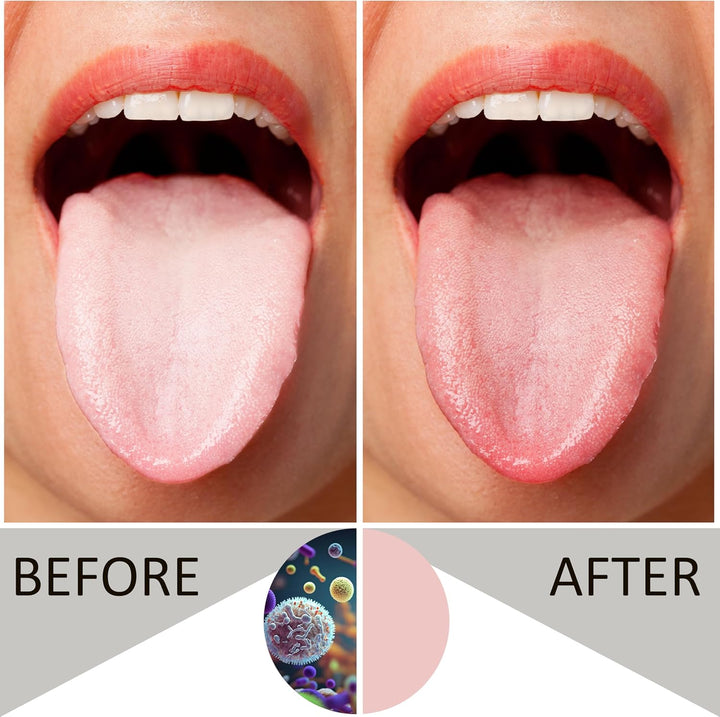 Tongue Scraper Metal Stainless Steel Tongue Scrapers for Adults Restore Fresh Breath Improve Taste and Oral Health with Our Tongue Cleaners Suitable for Men & Women Personal Hygiene - Tongue Scraper 2