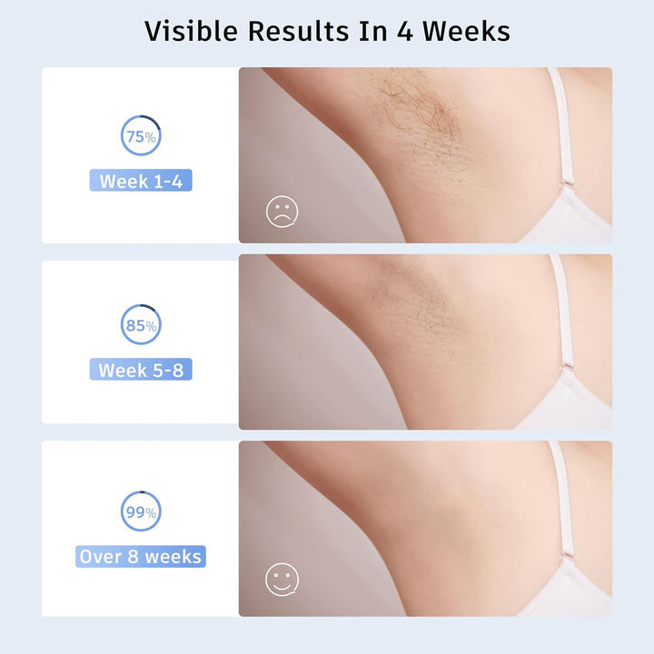 Laser Hair Remval Device, IPL Hair Removal 999,900 Flashes 9 Energy Level, Painless IPL Hair Remover Machine for Women and Men,Facial,Bikini,Body