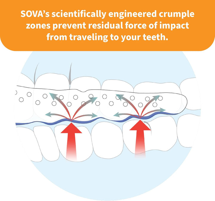 Junior Mouth Guard for Clenching and Grinding Teeth at Night, Custom-Fit Sleep Night Guard for Kids, Snow White