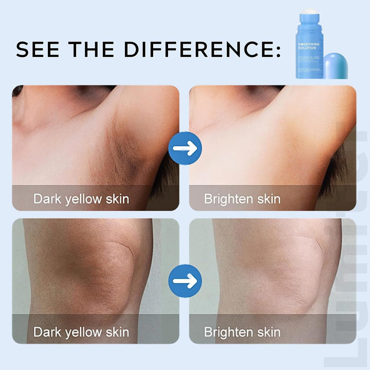 Smoothing Solution Ingrown Hair Treatment, after Shave Soothing Roll on Serum with BHA AHA, Razor Bump & Ingrown Hairs Serum for Men & Women Underarm/Face/Neck/Leg, Tend Skin Solution, 50ML