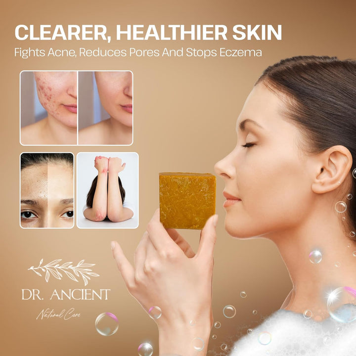 Sulphur Soap Bar, Best Sulfur Soap for Acne, Traditional Soaps for Oily Skin & Hair, anti Bacterial Sulfur Acne Treatment, Organic, Vegan, Pure Natural Handmade Acne Soaps