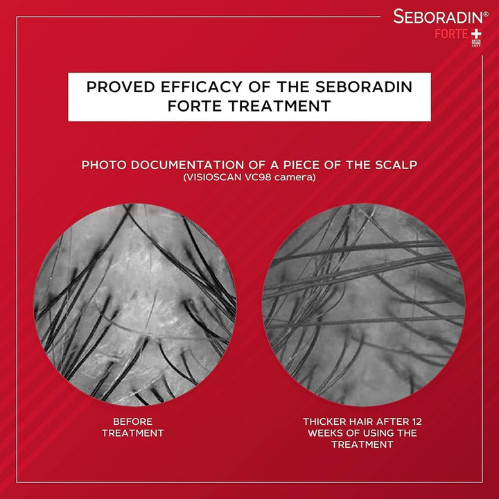 FORTE Hair Balm for Hair Loss Hair Thinning Premium Conditioner 200 Ml with Vitamins and Natural Extracts for Thickening and Growth Natur Technology Hair & Scalp Treatment Hair Care