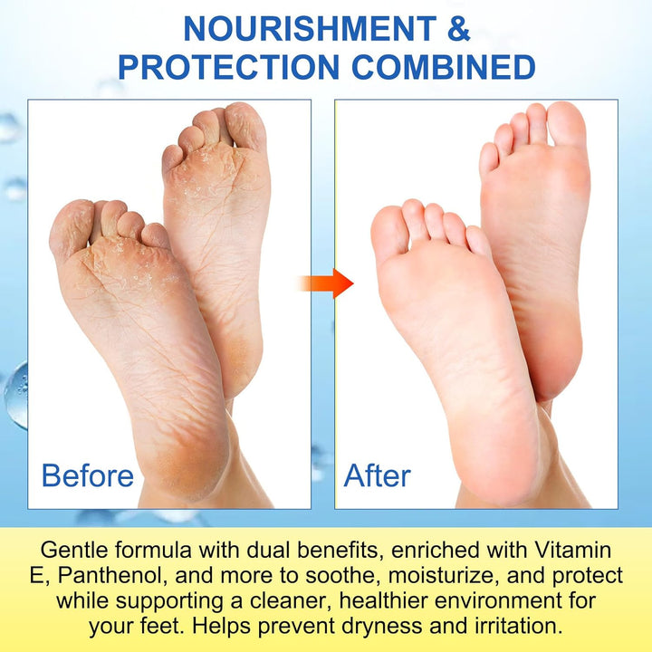 Antifungal Foot Spray 120Ml, Fast-Acting Athlete'S Foot Treatment with Tea Tree Oil, Odor Control & Shoe Sanitizer, 98% Natural Formula for Smelly Feet Relief in Men & Women