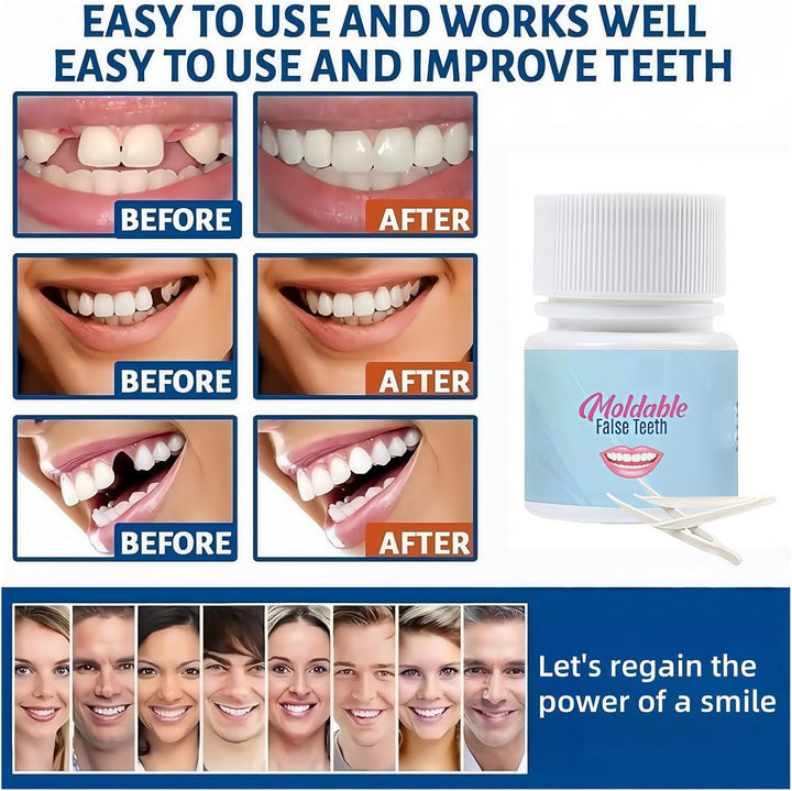 Temporary Tooth Filling Repair Kit with Tweezers,Moldable False Teeth for Replacing Missing or Broken Teeth,Dental Repair Beads,Temporary Tooth Filling,Tooth Filler,Fake Teeth,Versatile Applications