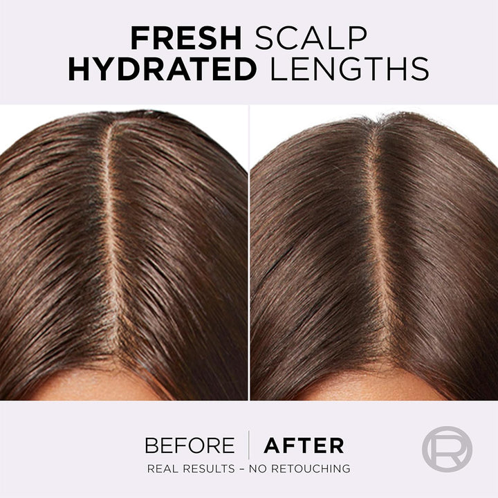 L’Oréal Paris Elvive Hydra Pure Exfoliating Pre-Shampoo Scalp Serum for Oily Scalp & Roots, with Salicylic Acid, Gently Cleansed of Excess Oil, Grease, Product Build-Up and Impurities, 102Ml