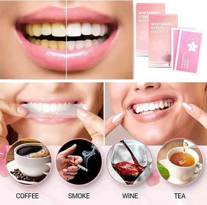Whitelab Teeth Stain Removal Whitening Strip Professional Teeth Stain Removal, Effective Removal of Stubborn Stains, Powerful Stain Removal Teeth, Reduces Yellowing-Default
