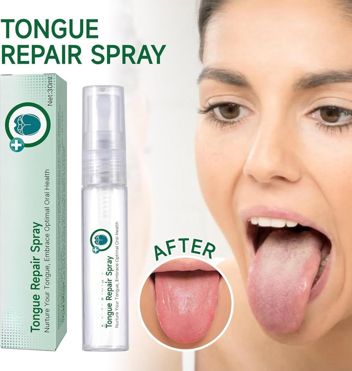 Tongue Repair Spray,Sore Tongue Relief,Mint Breath Spray,Breath Freshener Spray,Instant Dry Mouth Relief,Tongue Relief Treatment,Tongue Repair Spray for Dryness, White Coating and Bad Breath