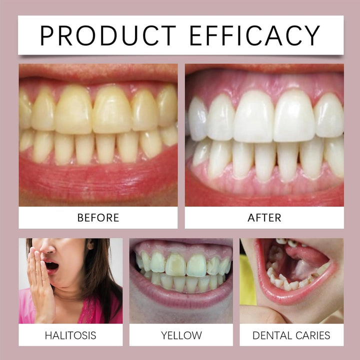 Dry Mouth Flavoured Spray,Fruit Oral Breath Spray,Mouth Freshener Spray,Breath Freshener Spray,Oral Care Spray,Fresh Breath Spray,Breath Freshener for Bad Breath,Oral Spray for Women&Men(Lemon Flavor)