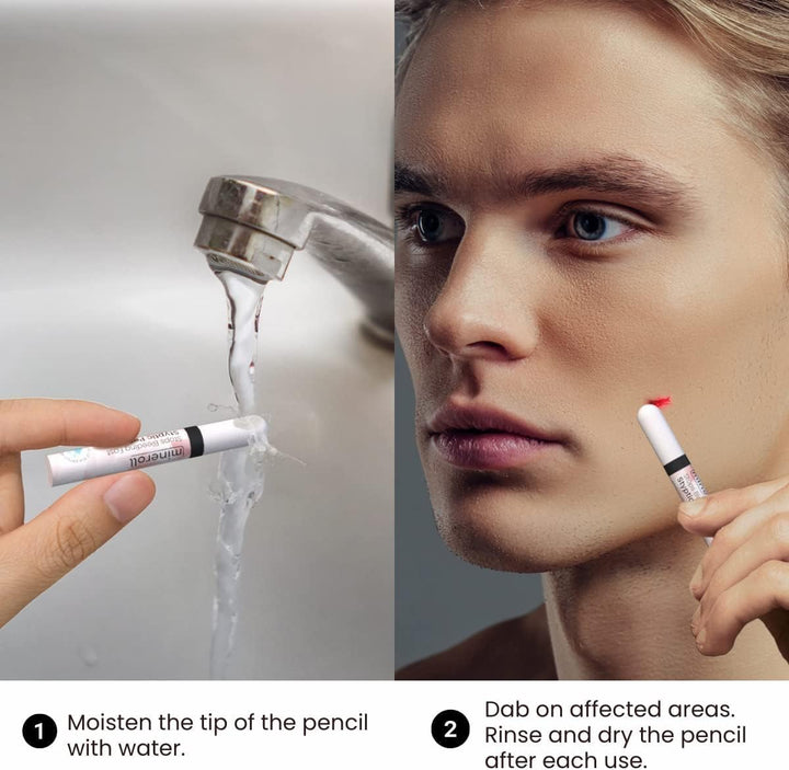 Styptic Pencils Shave Accessories (12 Pencils) Stops Bleeding Fast for Shaving Nicks, Razor Cuts for Men & Women - Sanitary and Great for Barbers or Personal (1)
