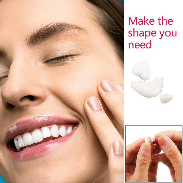 60G Tooth Repair Beads - Thermal Adhesive Fitting Beads Dental Tooth Filler Kit for Fixing Missing and Broken Teeth