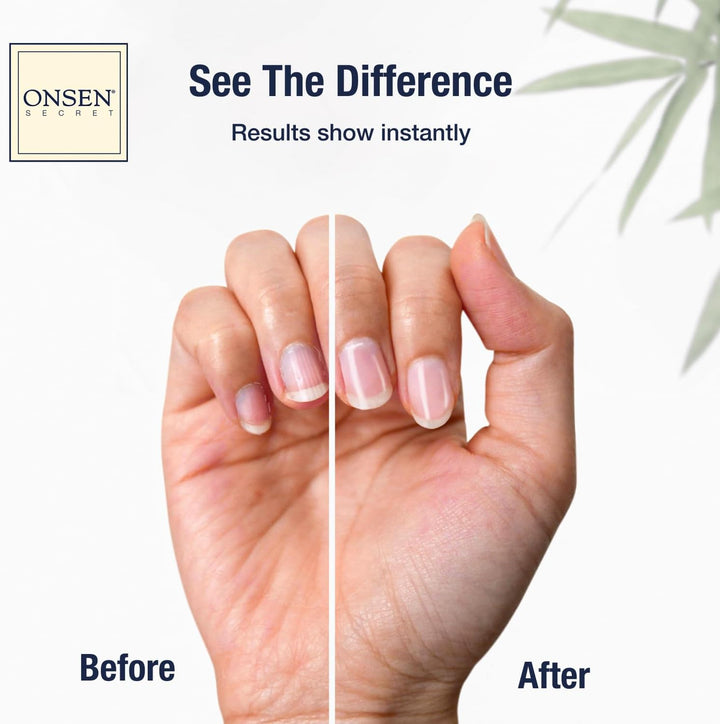 Nail & Cuticle Cream Treatment W/Japanese Tsubaki, Jojoba & Lavender Oil, Shea Butter - Strengthens Nails, Softens Cuticles - Daily Repair Care - 15Ml