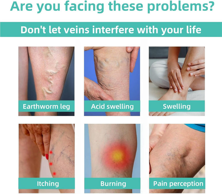 Varicose Veins Treatment for Legs,Spider Veins Removal for Legs Treatment Patch,Varicose Veins Patches,Varicose Veins Relief,Relief Pain Leg Care,Improve Blood Circulation,Wide Range of Application