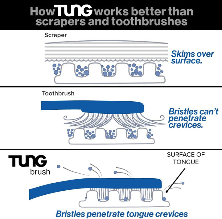 TUNG, the Original Gel Tongue Cleaner, Fresh Mint, 85 Gram