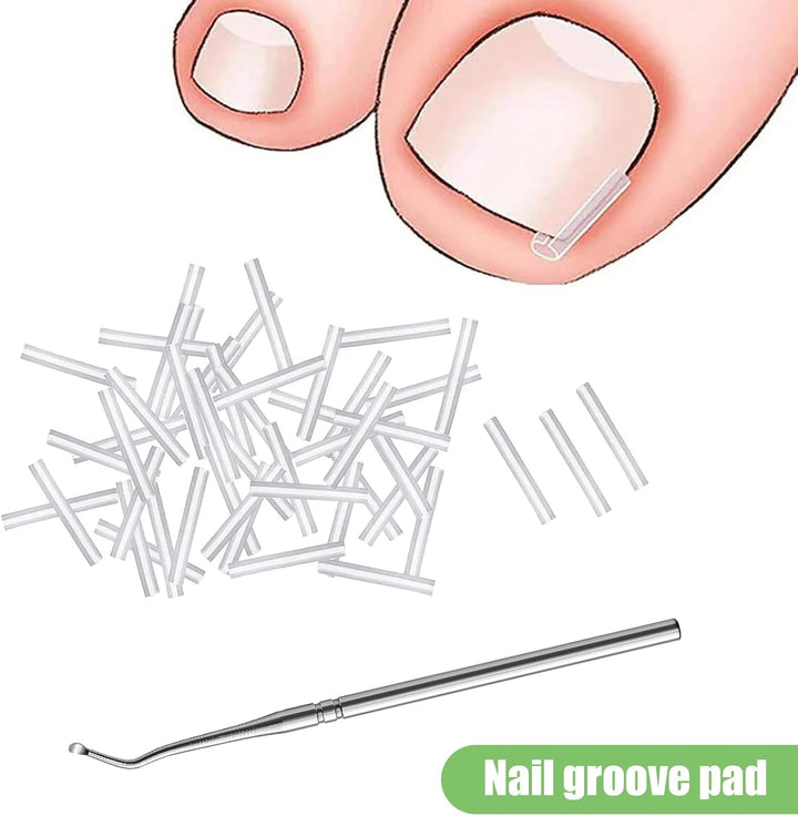 40 Pcs Ingrown Toenail Correction Strips, Toenail Straightener Strips, with Toenail Lifter, Ingrown Toenail Treatment Kit, Toenail Recover Clips, for Women Men Foot Care