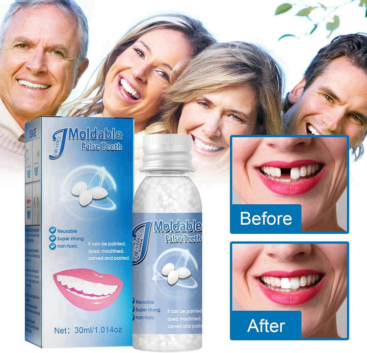 Temporary Tooth Filling,Repair Beads Tooth Repair Kit,Moldable False Teeth,Tooth Filling Repair Kit,Filling Kit for Teeth,Diy Tooth Repair Granules,Dental Repair Kit Filling,Broken Tooth Repair