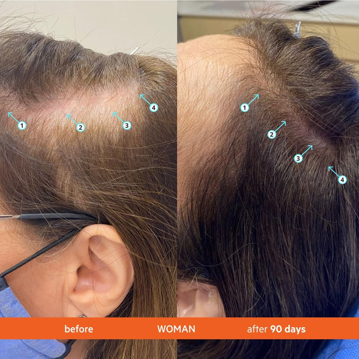 Revita High Performance Hair Stimulating Shampoo 205 Milliliter Anti-Hair Loss