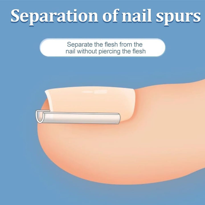 Ingrown Toenail Corrector Set - 50 PCS Pain-Free Toenail Straightener Strips with Toenail Lifter - Easy Use Ingrown Toenail Tools Kit