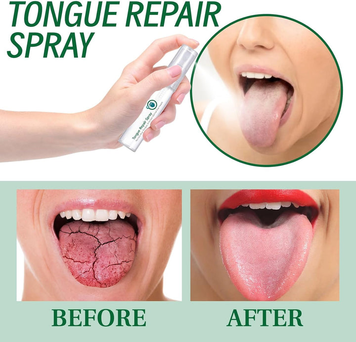 Tongue Repair Spray, Oral Antibacterial Spray, Instant Dry Mouth Relief, Fissured Tongue-Relief Sprays, Mint Breath Freshener Sprays, Tongue Repair-Spray for Dryness, White Coating and Bad Breath