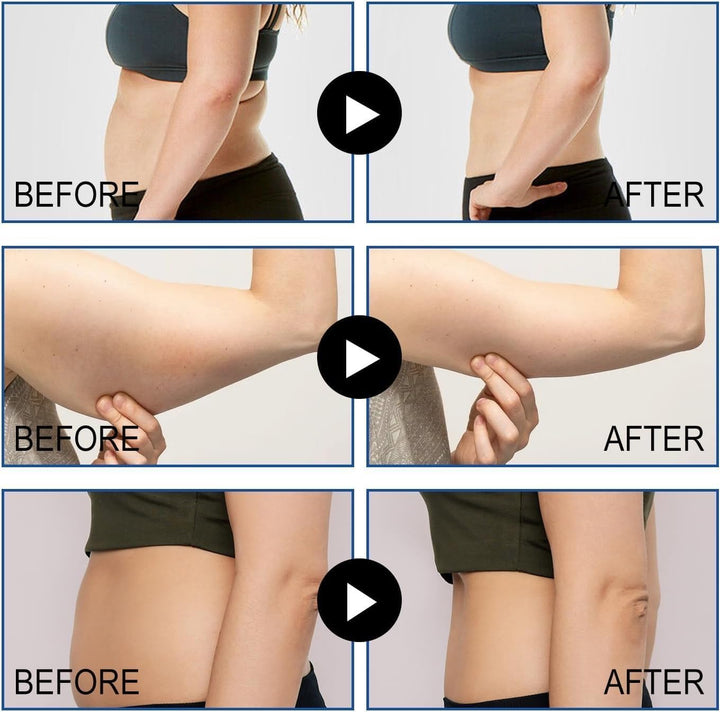 Slim Patch, Slimming Patch, 50 Pcs Weight Loss Patch, Fat Burning Patches for Belly Fat, Waist Slimming, Anti-Cellulite, Fast and Gentle Fat Reduction