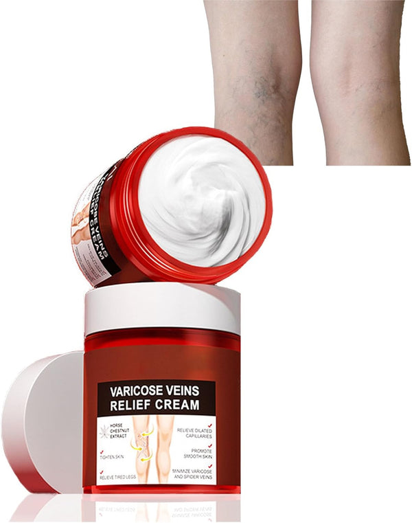 80G Varicose Veins Relief Cream, Varicose Veins Treatment for Legs, Varicose Veins Cream Vein Relief Cream Varicose Veins Treatment Cream for Legs Aching Legs Relief, Spider Veins Repair Cream