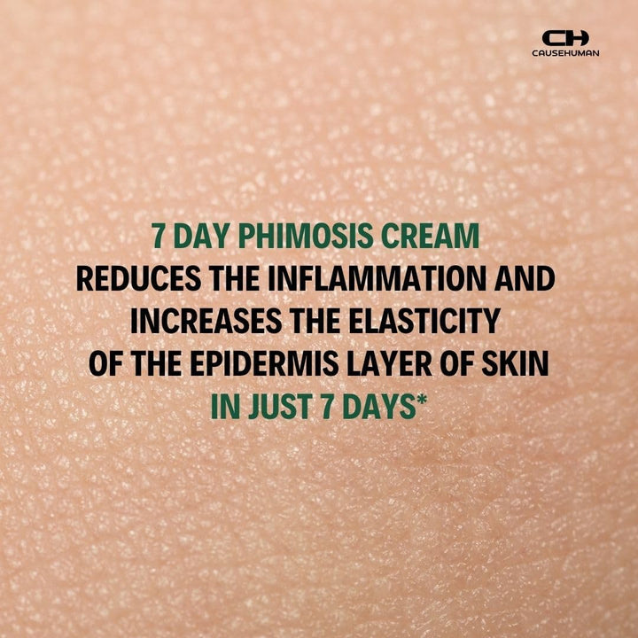 7-Day Phimosis Cream | Steroid Free Treatment for Fast Relief at Home | Visible Results in 7 Days* | 90G | No Irritation | Quick Relief