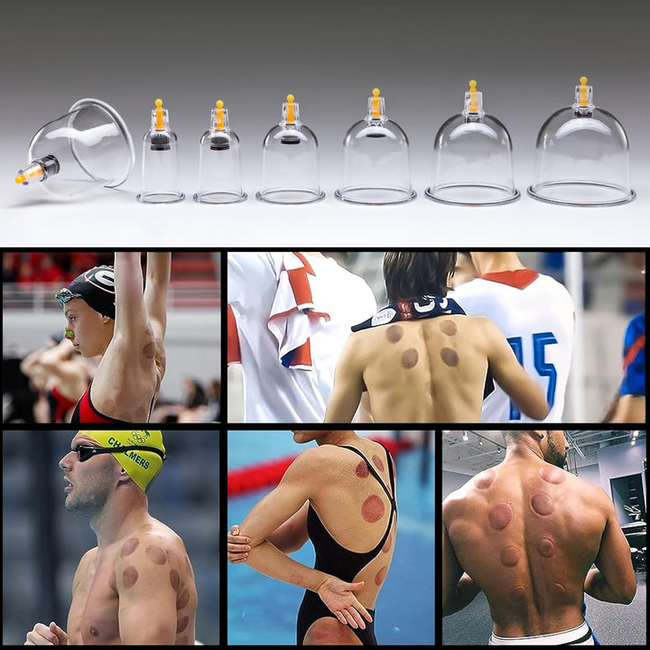 Cupping Therapy Set - 24 Suction Cups for Body, Muscle, Neck and Back Pain Relief - anti Cellulite Massage Hijama Kit