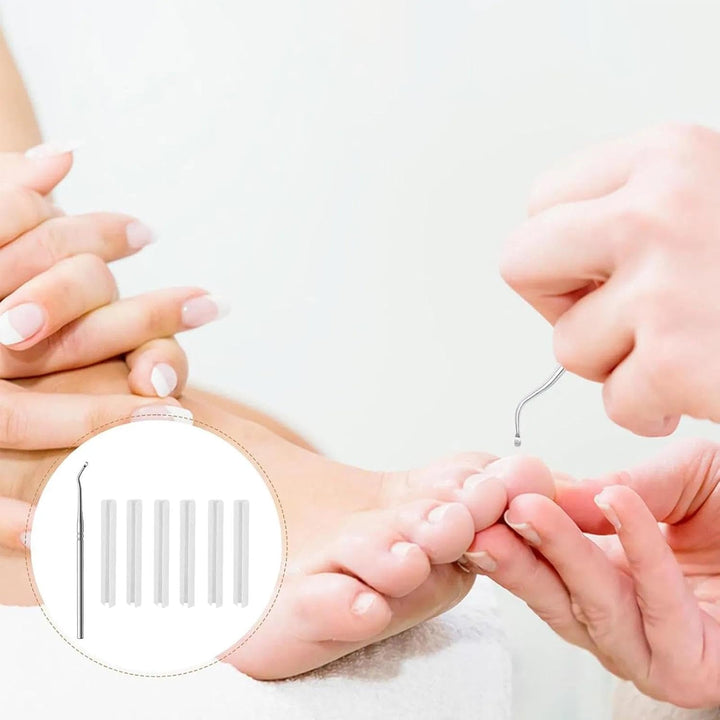 (50+1) Pcs Ingrown Toenail Tool Kit - Corrector with Lifter & Straightener Strips, Pain-Free Treatment for In-Grown Toe Nails, Easy Fixed Toenail Correction Tool.