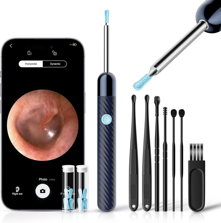 Ear Wax Removal - Earwax Remover Tool with 7 Pcs Ear Set - Ear Cleaner 1080P HD Ear Scope - Camera with 6 Led Lights - Ear Cleaning Kit with 11 Ear Spoon - Ear Camera for Ios & Android（Glossy Black）