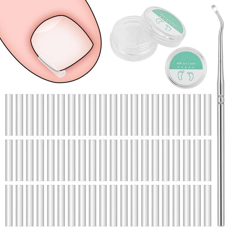 Ingrown Toenail Removal Kit, Ingrown Toenail-Corrector Tools with Podiatry-Toenail Braces, Silicone Toe Strap, Toenail Straightener Strips and Patch for Toe Pain Relief
