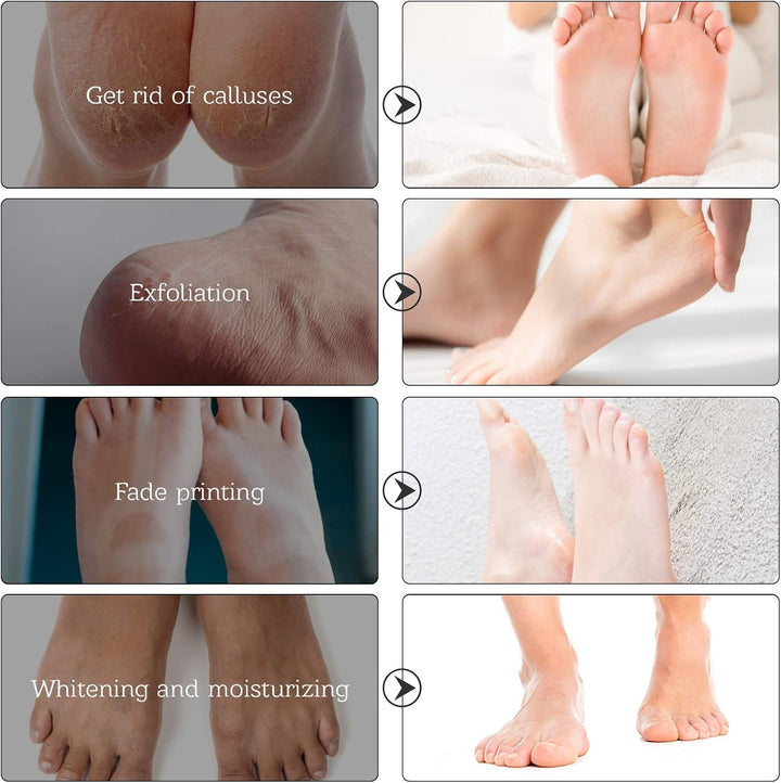 Foot Peel Mask 2 Pack, Callus Remover & Exfoliating Foot Mask for Men & Women, Baby Soft Smooth Touch Feet - Lavender