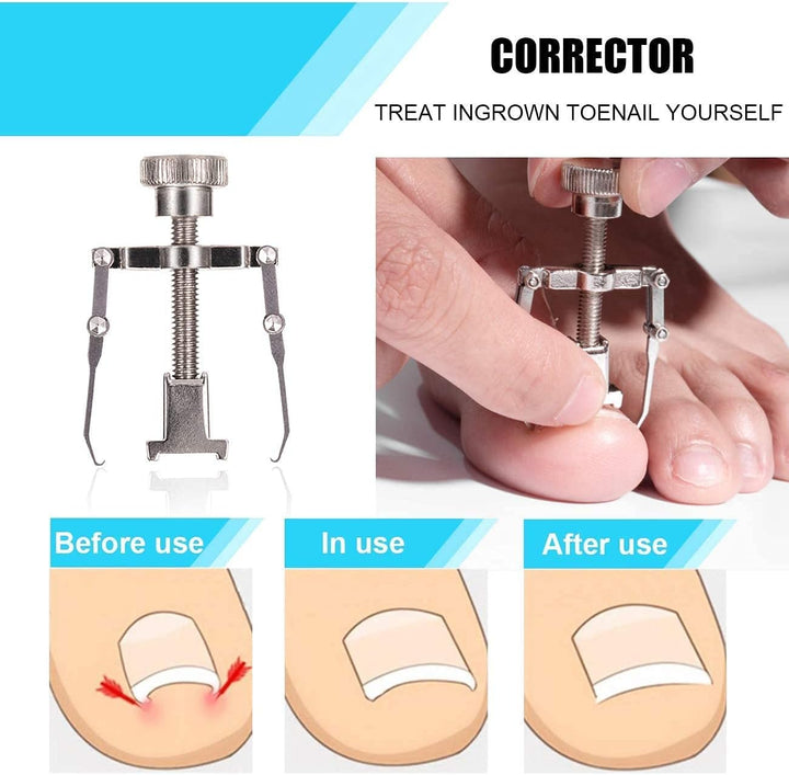 Toenail Clippers Set 7Pcs, Staineless Steel Ingrown Toenail Tool Kit, Professional Toe Nail Nippers Set for Ingrown & Thick Nail, Surgery Grade Manicure Pedicure Tool by