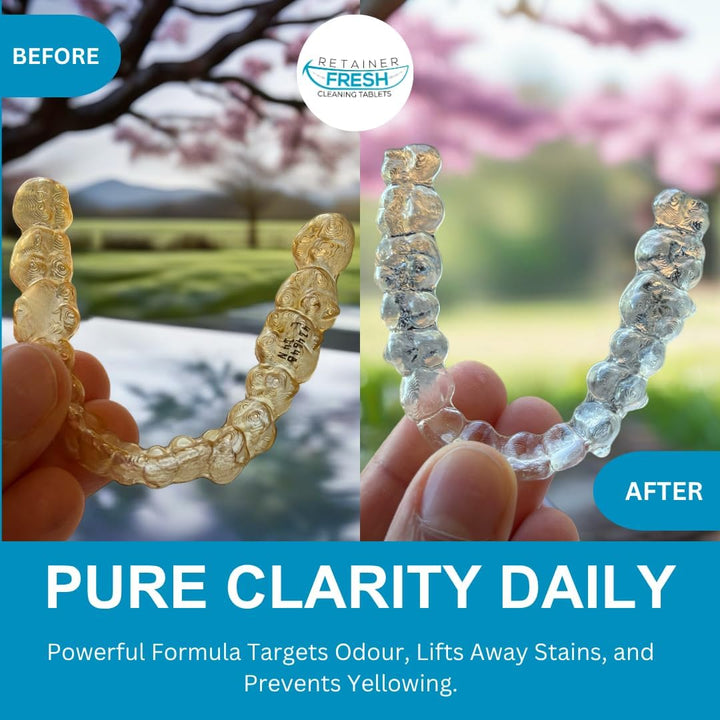 Retainer Cleaner Tablets - 120 Tablets 4 Month  - Retainer Cleaning Tablets, Mouth Guard Cleaner, Denture Cleaner, Aligner Cleaner, Brite Retainer Tablets